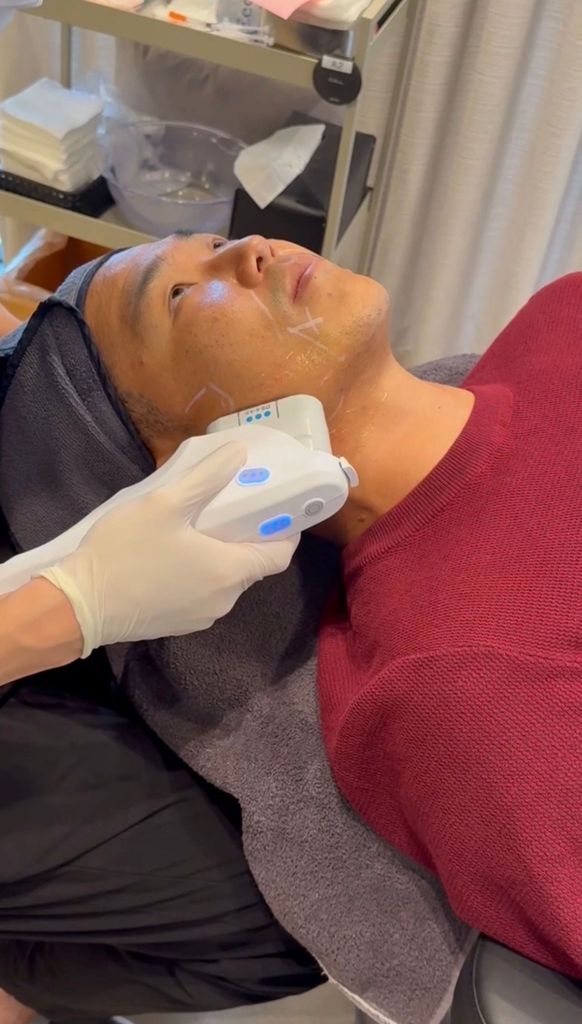Eddie receiving facial Ultherapy